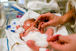 Baby in Neonatal unit Baby in Neonatal unit